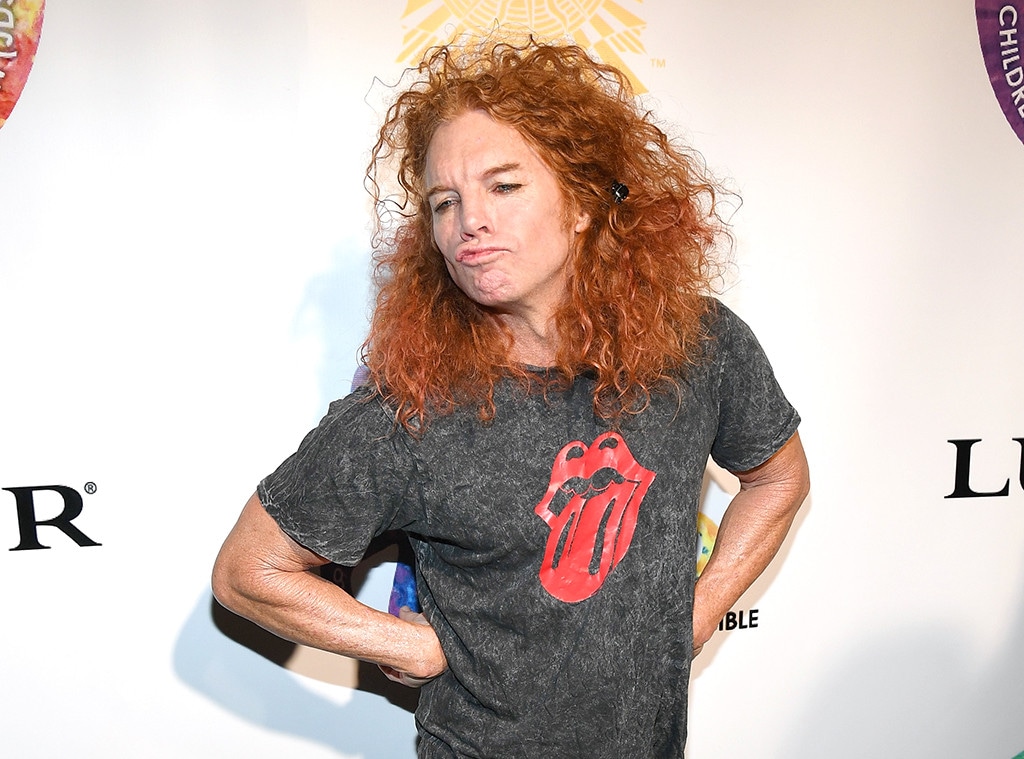 What Happened to Carrot Top?